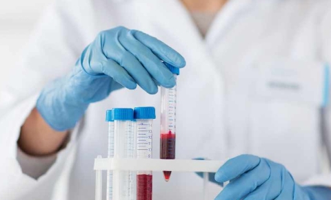 352 mln leke per check-up ne 2020: Buxheti pagoi per sherbime te pakryera